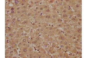 IHC image of ABIN7149404 diluted at 1:300 and staining in paraffin-embedded human liver tissue performed on a Leica BondTM system. (PLA2G4B Antikörper  (AA 514-781))