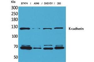 Western Blot (WB) analysis of BT474, A549, SHSY5Y, 293 cells using K-cadherin Polyclonal Antibody.