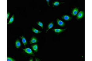 Immunofluorescent analysis of A549 cells using ABIN7149021 at dilution of 1:100 and Alexa Fluor 488-congugated AffiniPure Goat Anti-Rabbit IgG(H+L)