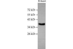 Western Blot analysis of Rat Heart using EpCAM Polyclonal Antibody at dilution of 1:500 (EpCAM Antikörper)
