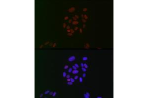 Immunofluorescence analysis of U-2 OS cells using CIRBP Rabbit mAb (ABIN7266452) at dilution of 1:100 (40x lens). (CIRBP Antikörper)
