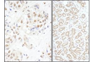 Immunohistochemistry (IHC) image for anti-V-Myb Myeloblastosis Viral Oncogene Homolog (Avian) (MYB) (AA 1-50) antibody (ABIN7453466) (MYB Antikörper  (AA 1-50))