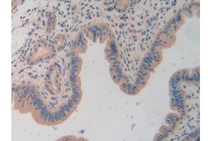 DAB staining on IHC-P; Samples: Mouse Uterus Tissue (TOR1A Antikörper  (AA 41-333))