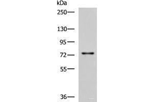 Western blot analysis of Rat liver tissue lysate using TGFBI Polyclonal Antibody at dilution of 1:850 (TGFBI Antikörper)