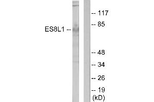 Immunohistochemistry analysis of paraffin-embedded human colon carcinoma tissue using ES8L1 antibody.