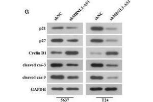 Inhibition of MBNL1-AS1 promoted the tumorigenesis of BC cells through the regulation of miR-135a/PHLPP2/FOXO1 in vivo. (Cyclin D1 Antikörper  (AA 96-295))