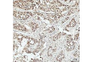 IHC analysis of DHX15/prp43 using anti-DHX15/prp43 antibody (ABIN7602738).