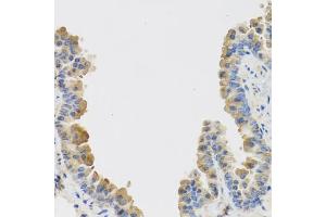 Immunohistochemistry of paraffin-embedded mouse lung using IL25 antibody (ABIN5974535) at dilution of 1/100 (40x lens). (IL-25 Antikörper)