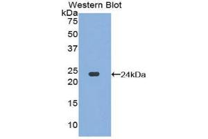 Western Blotting (WB) image for anti-Dishevelled Segment Polarity Protein 1 (DVL1) (AA 150-332) antibody (ABIN3202637) (DVL1 Antikörper  (AA 150-332))