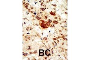 Immunohistochemistry (Paraffin-embedded Sections) (IHC (p)) image for anti-Ephrin Type A Receptor 1 (EPHA1) (AA 913-943), (C-Term) antibody (ABIN391884)