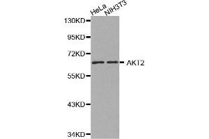 Western Blotting (WB) image for anti-V-Akt Murine Thymoma Viral Oncogene Homolog 2 (AKT2) antibody (ABIN3020945) (AKT2 Antikörper)
