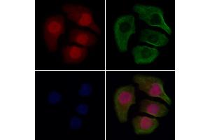 ABIN7094583 and ABIN7098632 staining Hela cells by IF/ICC.