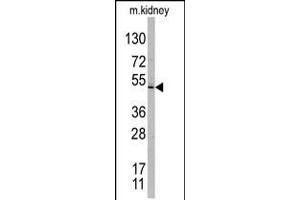 Western blot analysis of TASP1 C-term polyclonal antibody in mouse kidney tissue lysates. (TASP1 Antikörper  (C-Term))