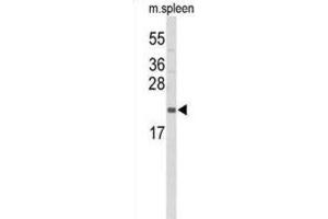 Western Blotting (WB) image for anti-Interleukin 31 (IL31) antibody (ABIN3004157)