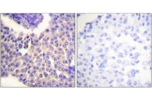 Immunohistochemistry (IHC) image for anti-S-Antigen, Retina and Pineal Gland (Arrestin) (SAG) (AA 369-418), (pSer412) antibody (ABIN1531297)