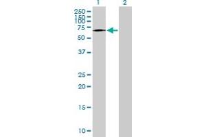 Western Blotting (WB) image for anti-TATA Box Binding Protein (TBP)-Associated Factor, RNA Polymerase I, B, 63kDa (TAF1B) (AA 1-588) antibody (ABIN522447)