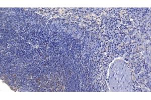 Detection of FASL in Human Spleen Tissue using Polyclonal Antibody to Factor Related Apoptosis Ligand (FASL) (FASL Antikörper  (AA 102-280))