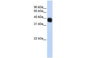 WB Suggested Anti-SSBP3 Antibody Titration: 0. (SSBP3 Antikörper  (Middle Region))