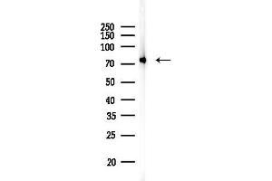 anti-Heat Shock 70kDa Protein 9 (Mortalin) (HSPA9) antibody