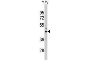 Western blot analysis of PSMD13 Antibody (C-term) in Y79 cell line lysates (35ug/lane).