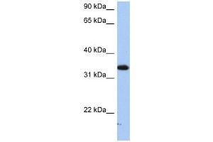 SULT6B1 antibody used at 1 ug/ml to detect target protein. (SULT6B1 Antikörper  (C-Term))