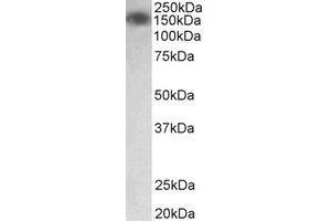Western Blotting (WB) image for anti-Myosin Light Chain Kinase (MYLK) (Internal Region) antibody (ABIN2465035)