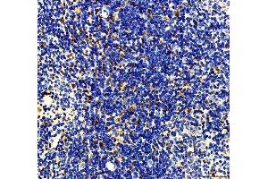 IHC analysis of MTA2 using anti-MTA2 antibody (ABIN7599519).