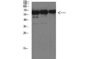 Western Blot analysis of Luciferase protein using Luciferase Monoclonal Antibody at dilution of 1:1000. (Luciferase Antikörper)