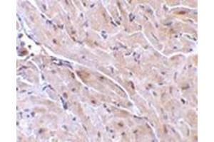 Immunohistochemistry of TRIAD3A in mouse heart with this product at 10 μg/ml. (RNF216 Antikörper  (N-Term))