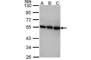 WB Image Sample (30 ug of whole cell lysate) A: A431 , B: H1299 C: Hela 10% SDS PAGE TRIP15antibody antibody diluted at 1:1000 (COPS2 Antikörper  (C-Term))