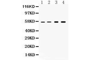 Western blot analysis of Cytokeratin 18 expression in rat liver extract ( Lane 1), mouse liver extract ( Lane 2), HELA whole cell lysates ( Lane 3) and HEPG2 whole cell lysates ( Lane 4). (Cytokeratin 18 Antikörper  (AA 204-430))