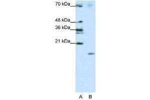 WB Suggested Anti-SRP19  Antibody Titration: 1. (SRP19 Antikörper  (Middle Region))