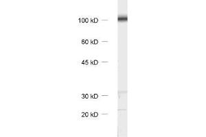 Western Blotting (WB) image for anti-Catenin, beta (CATNB) (AA 768-782) antibody (ABIN1742544) (beta Catenin Antikörper  (AA 768-782))