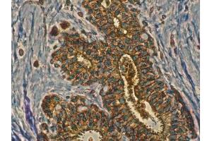 Anti-Rab11a antibody IHC Staining of human mammary tissue, Immunohistochemistry of formalin-fixed, paraffin-embedded tissue after heat-induced antigen retrieval, antibody concentration 1/200, (RAB11A Antikörper  (C-Term))