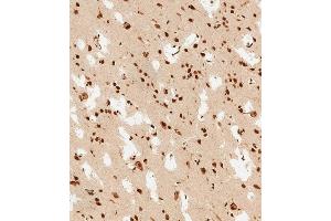 (ABIN6243826 and ABIN6578813) staining PSMD3 in human brain tissue sections by Immunohistochemistry (IHC-P - paraformaldehyde-fixed, paraffin-embedded sections). (PSMD3 Antikörper  (AA 482-515))