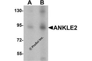 Western Blotting (WB) image for anti-Ankyrin Repeat and LEM Domain Containing 2 (ANKLE2) (Middle Region) antibody (ABIN1030852) (ANKLE2 Antikörper  (Middle Region))