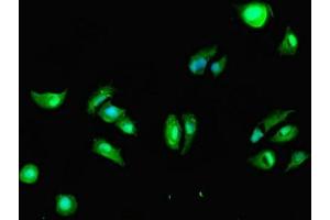 Immunofluorescent analysis of MCF-7 cells using ABIN7149554 at dilution of 1:100 and Alexa Fluor 488-congugated AffiniPure Goat Anti-Rabbit IgG(H+L)