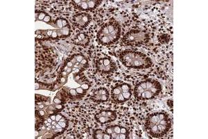 Immunohistochemical staining of human colon with FAM103A1 polyclonal antibody  shows strong nuclear positivity in glandular cells at 1:1000-1:2500 dilution. (FAM103A1 Antikörper)