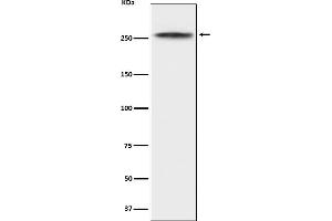 Western blot analysis of CHD3 expression in K562 cell lysate. (Rekombinanter CHD3 Antikörper)