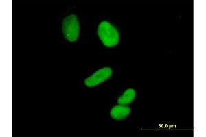 Immunofluorescence of purified MaxPab antibody to CCNH on HeLa cell. (Cyclin H Antikörper  (AA 1-323))