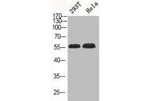 Western Blot analysis of 293T HELA cells using Phospho-Akt1/3 (Y437/434) Polyclonal Antibody (AKT1/3 (pTyr434), (pTyr437) Antikörper)