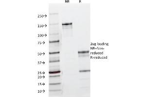 SDS-PAGE Analysis Purified EGFR Mouse Monoclonal Antibody (B1D8). (EGFR Antikörper)