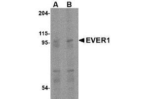 Image no. 1 for anti-Transmembrane Channel-Like 6 (TMC6) (Internal Region) antibody (ABIN1493617) (TMC6 Antikörper  (Internal Region))