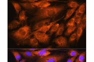 Immunofluorescence analysis of C6 cells using ATP5D Polyclonal Antibody at dilution of 1:100. (ATP5F1D Antikörper)