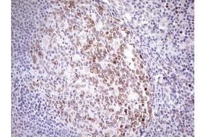 Immunohistochemistry (IHC) image for anti-Achalasia, Adrenocortical Insufficiency, Alacrimia (AAAS) (AA 322-546) antibody (ABIN2715861) (Adracalin Antikörper  (AA 322-546))