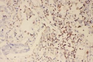 IHC analysis of Profilin 1 using anti-Profilin 1 antibody (ABIN3043603). (PFN1 Antikörper  (C-Term))