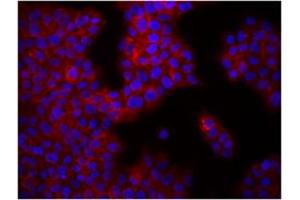 Image no. 1 for anti-Integrin beta 1 (ITGB1) antibody (ABIN205424) (ITGB1 Antikörper)