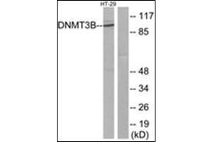 Western blot analysis of extracts from HT-29 cells, using DNMT3B Antibody. (DNMT3B Antikörper  (N-Term))