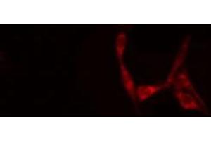 ABIN6277707 staining Hela cells by IF/ICC.