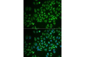 Immunofluorescence analysis of A549 cells using GPLD1 antibody (ABIN5973975). (GPLD1 Antikörper)